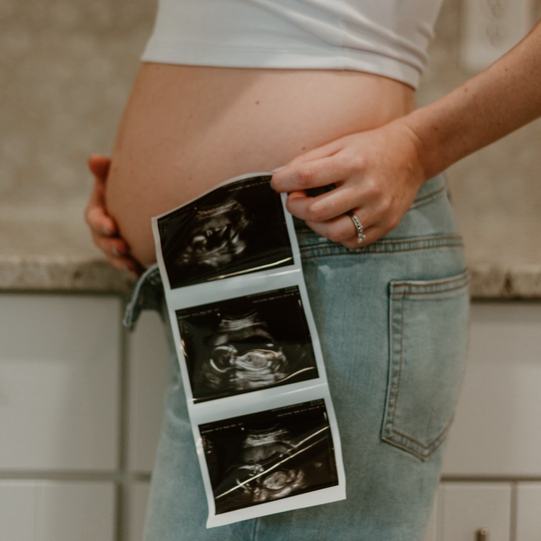 Photo shared by Rachel for their Babylist baby registry.