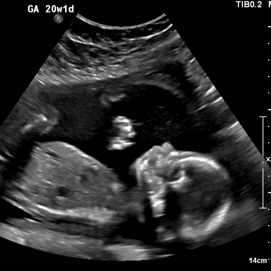 Photo shared by Samantha for their Babylist baby registry.