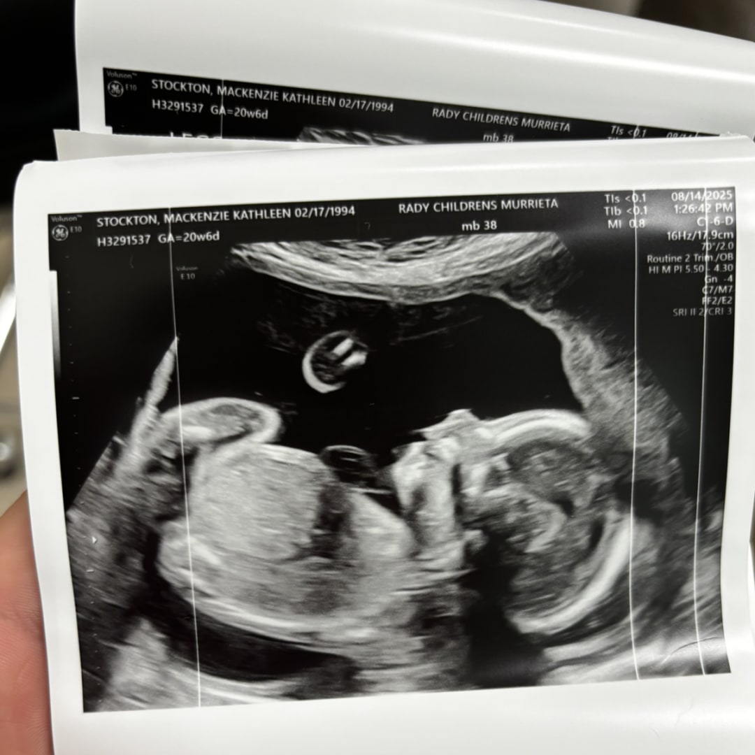 Photo shared by Mackenzie for their Babylist baby registry.