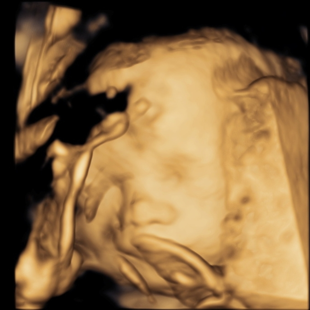 Photo shared by Gyzelle Jena for their Babylist baby registry.