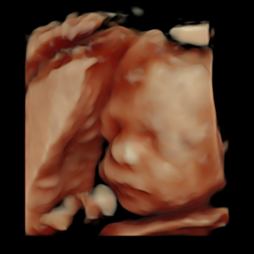 Photo shared by Sara for their Babylist baby registry.