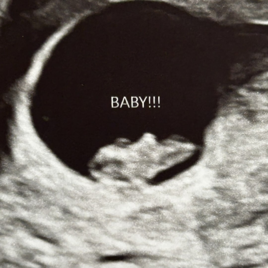 Photo shared by Hannah for their Babylist baby registry.