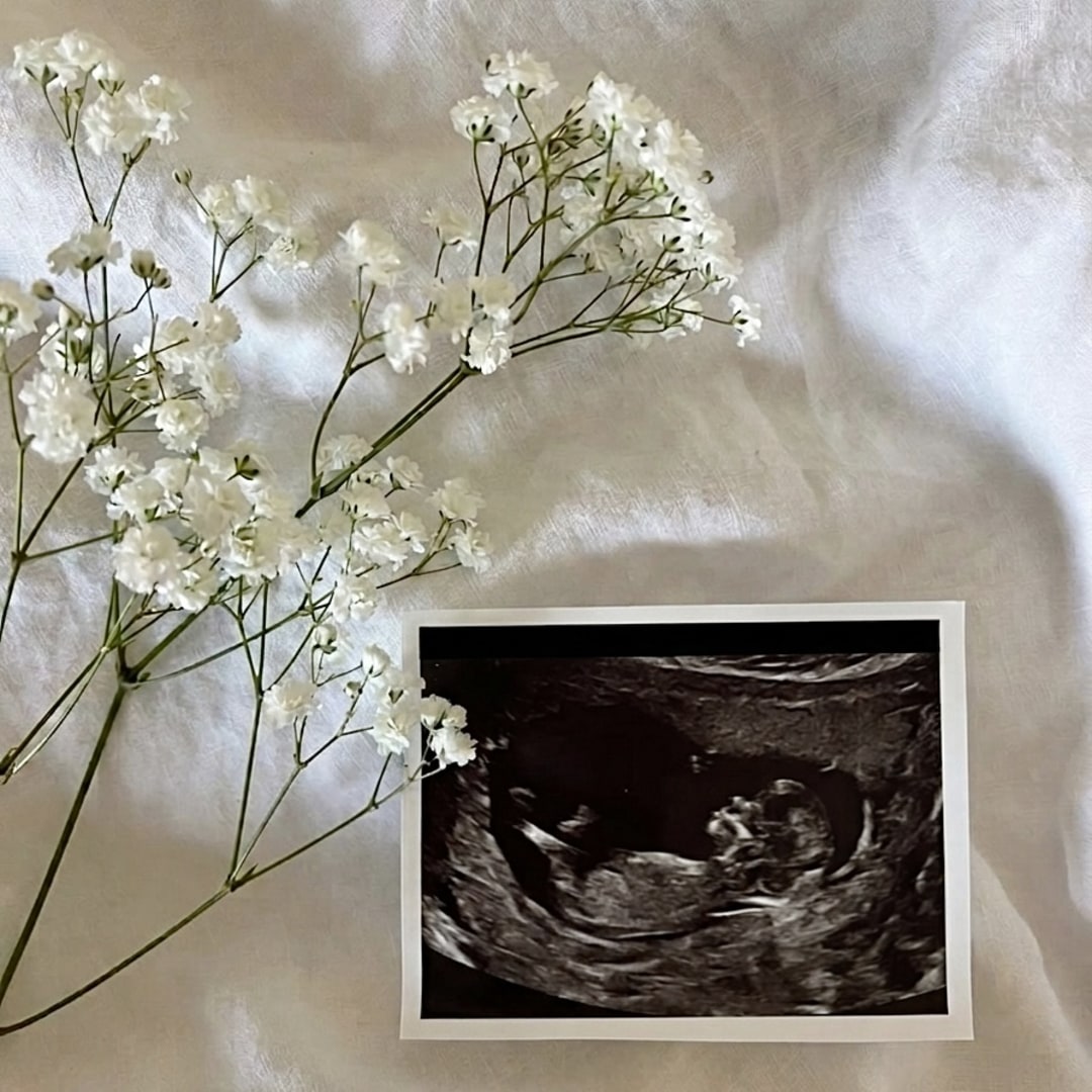 Photo shared by Shelby for their Babylist baby registry.