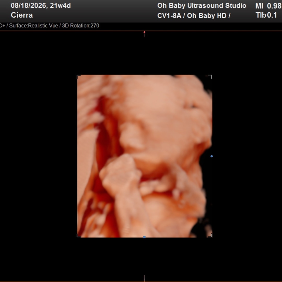 Photo shared by Cierra for their Babylist baby registry.