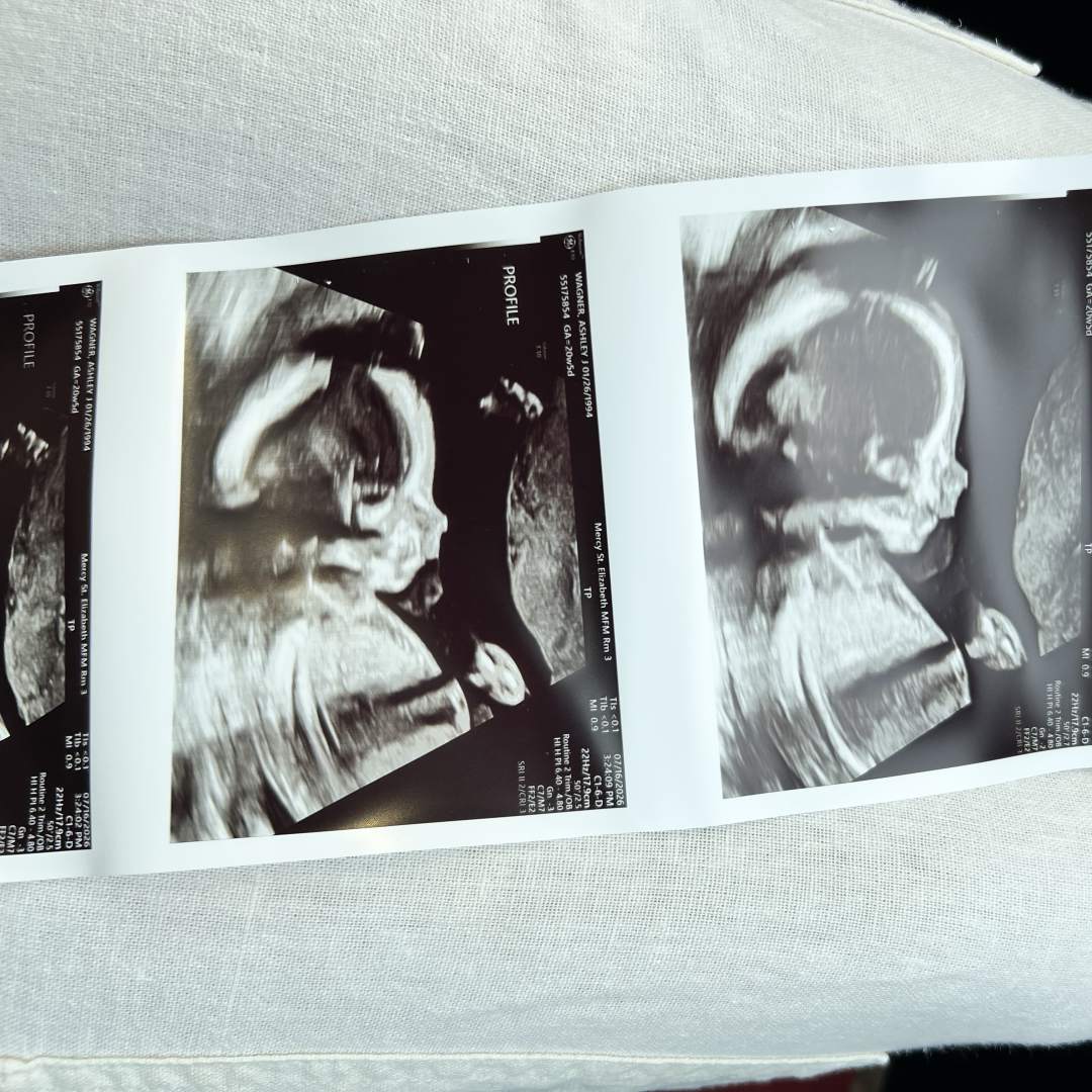 Photo shared by Ashley for their Babylist baby registry.