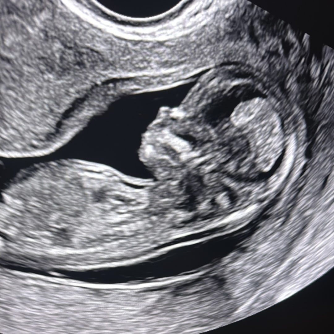 Photo shared by Elizabeth for their Babylist baby registry.