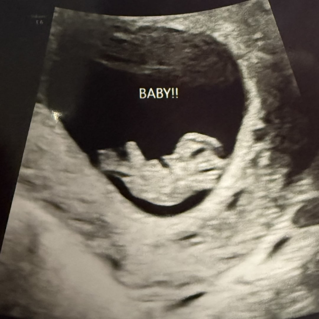 Photo shared by Colleen for their Babylist baby registry.