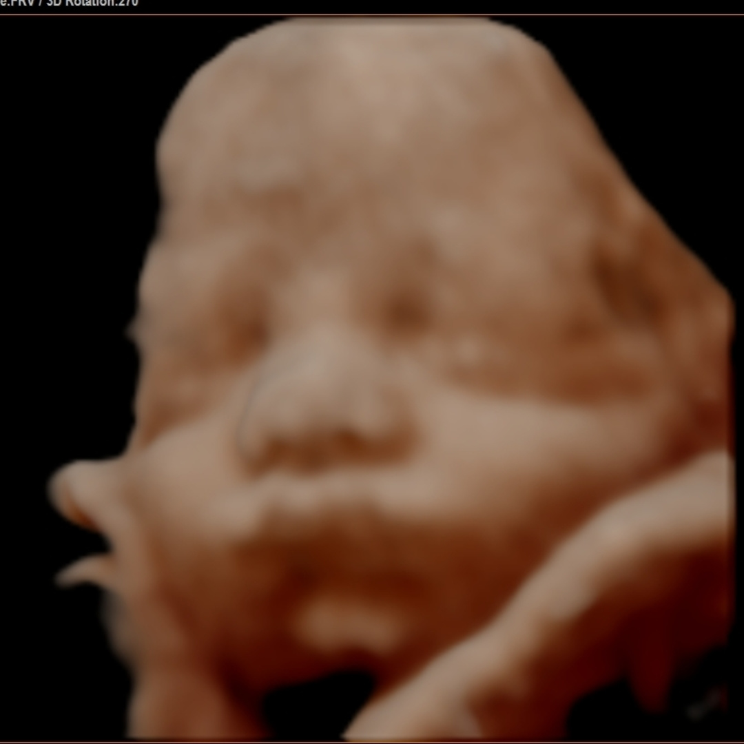 Photo shared by Paige for their Babylist baby registry.