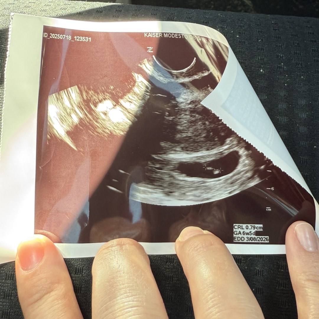 Photo shared by Ella for their Babylist baby registry.