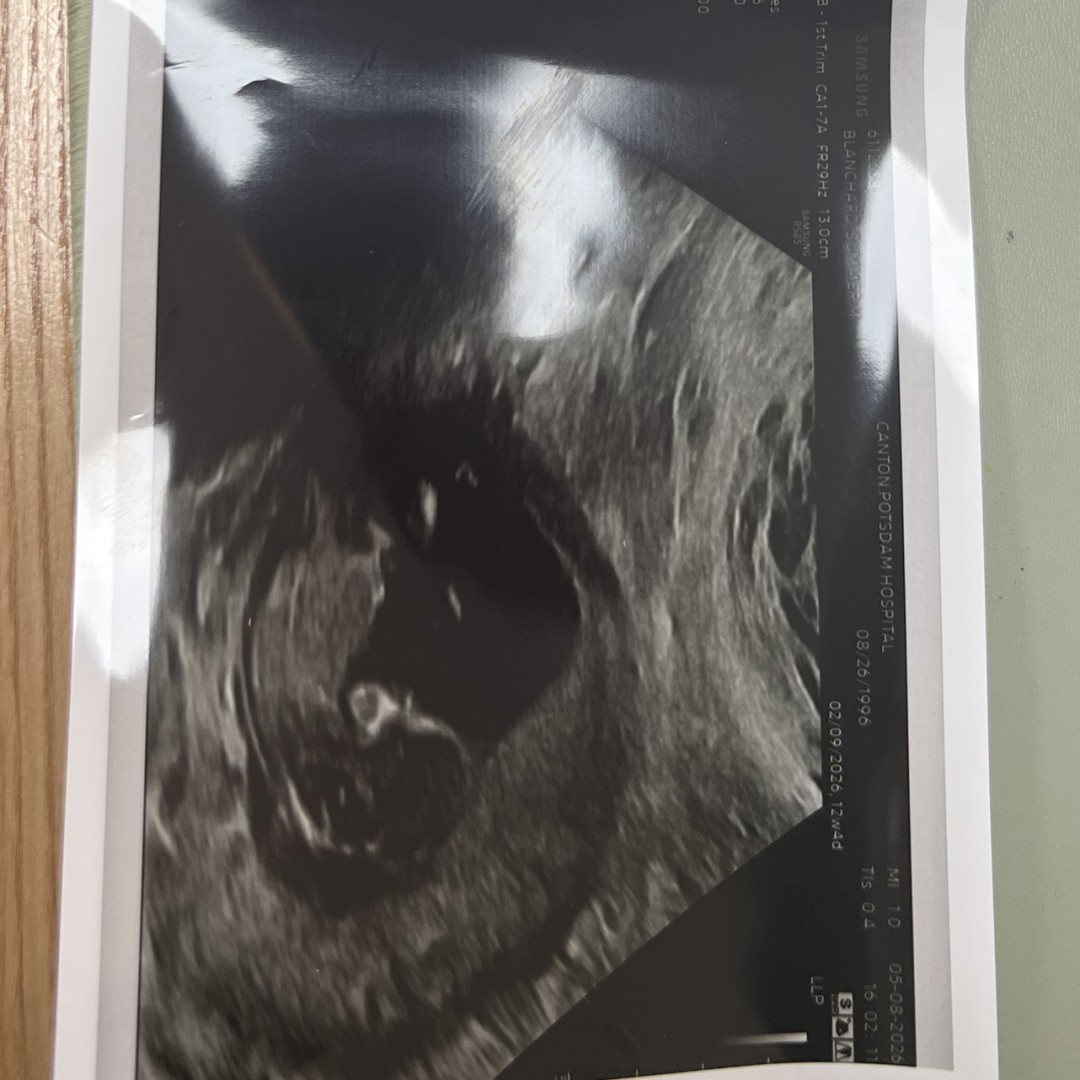 Photo shared by Summer for their Babylist baby registry.