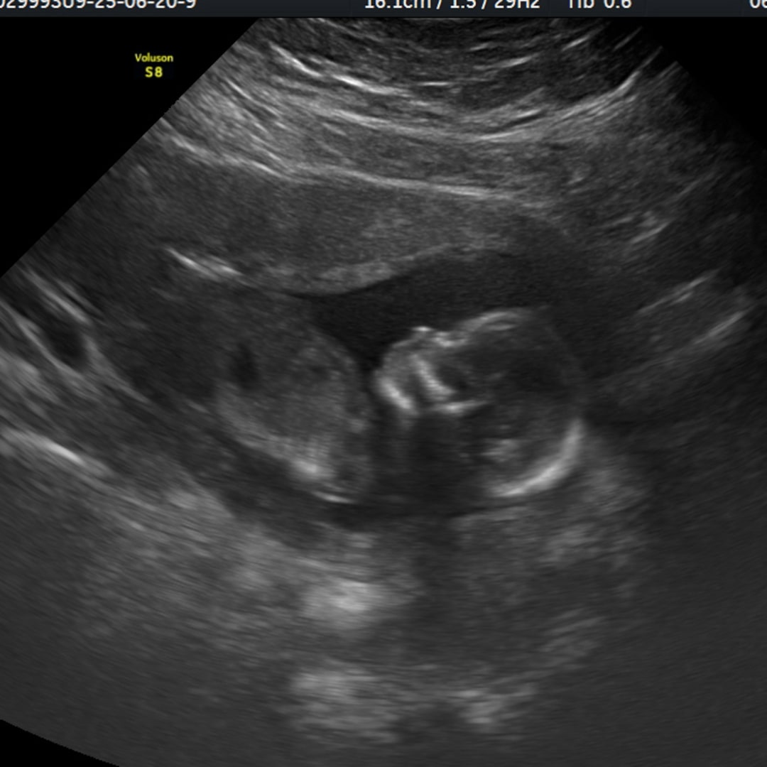 Photo shared by Mariela for their Babylist baby registry.