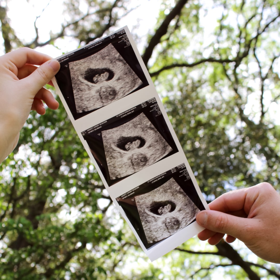 Photo shared by Cassidy for their Babylist baby registry.