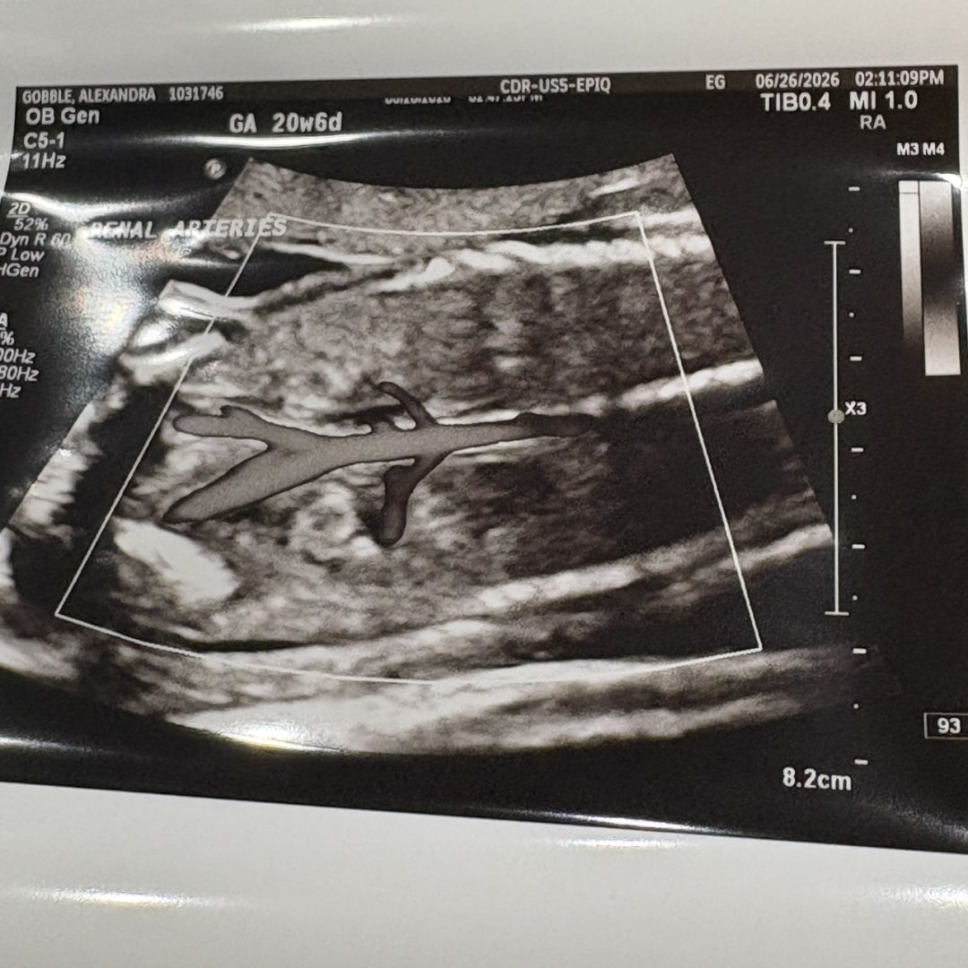 Photo shared by Alexandra for their Babylist baby registry.