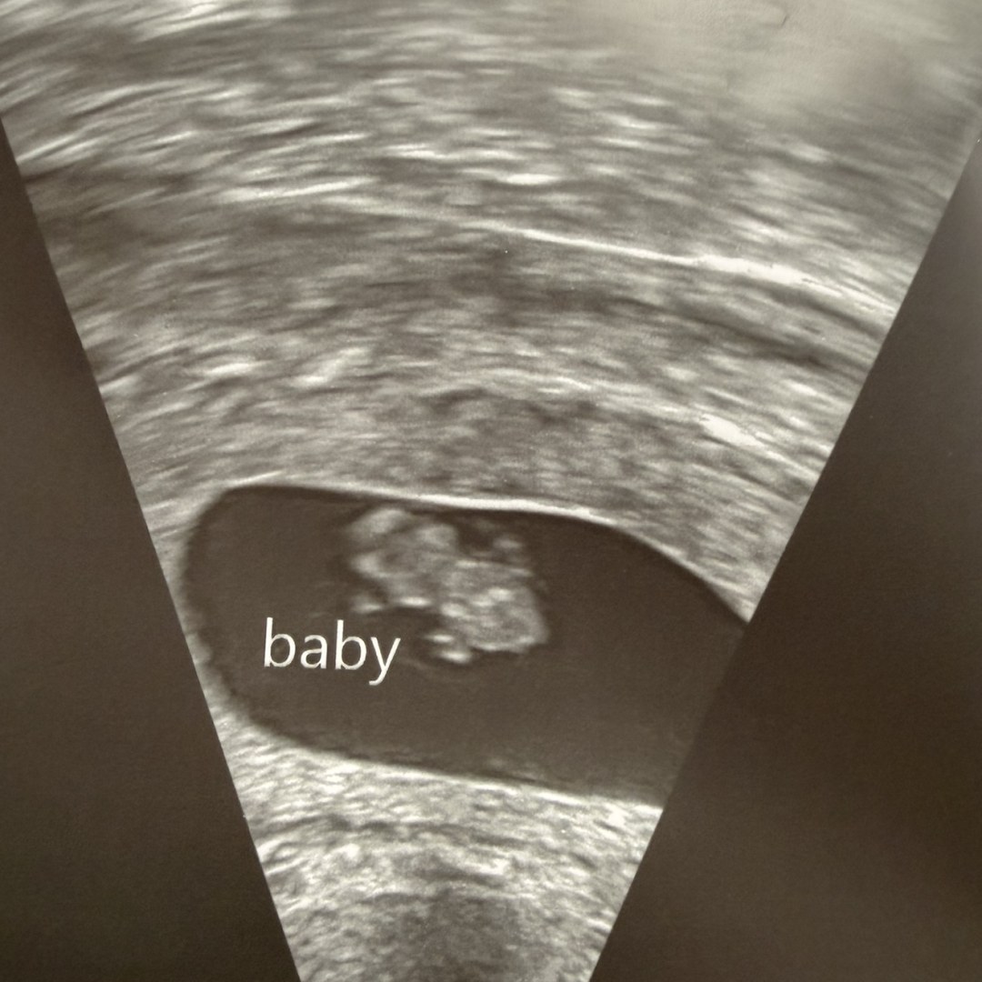 Photo shared by Cailey for their Babylist baby registry.