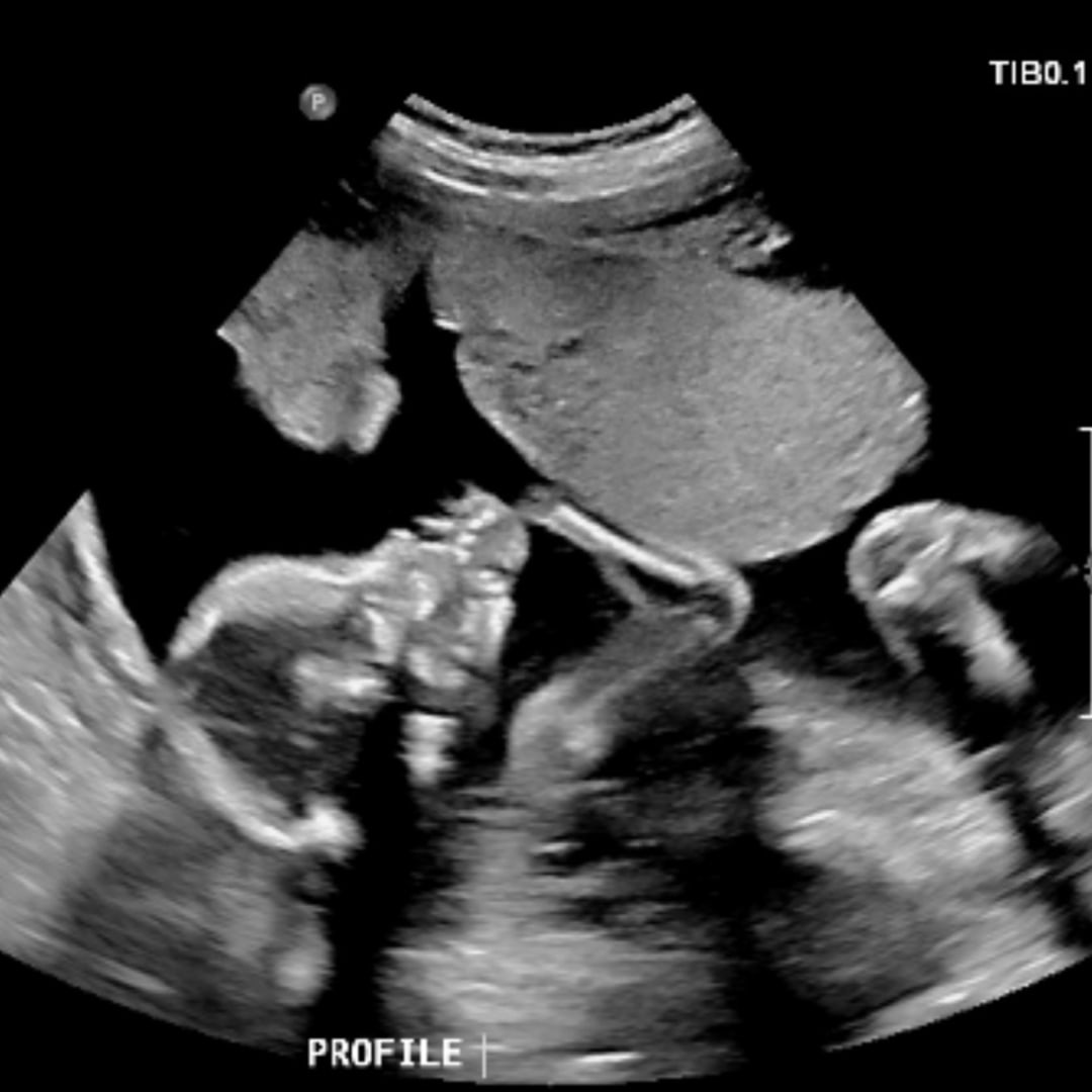 Photo shared by Claire for their Babylist baby registry.