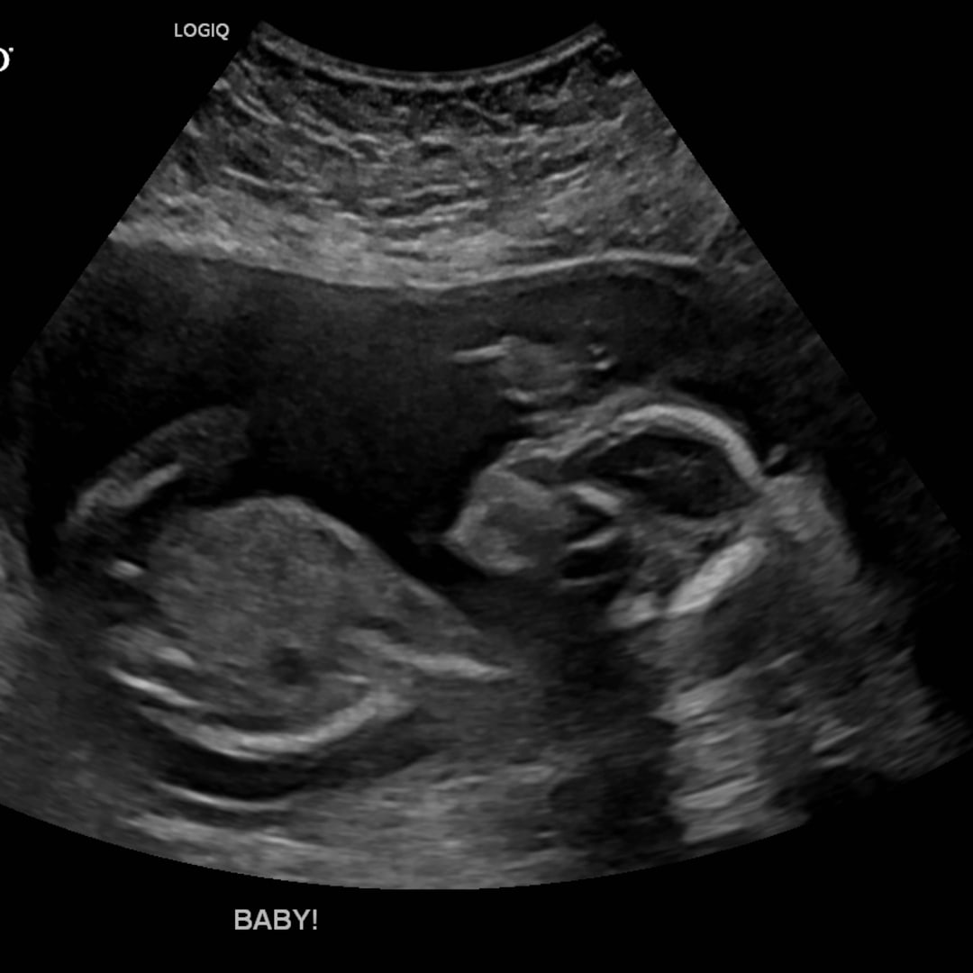 Photo shared by Rebecca for their Babylist baby registry.