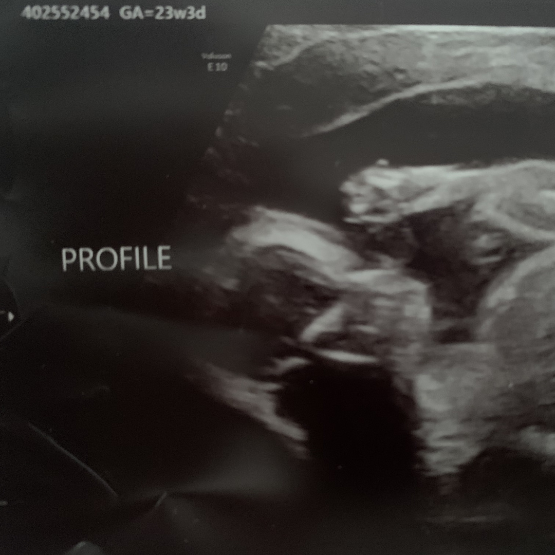 Photo shared by Katie for their Babylist baby registry.
