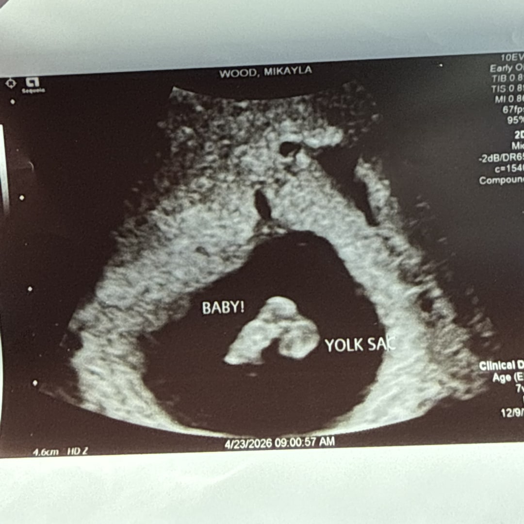 Photo shared by Mikayla for their Babylist baby registry.