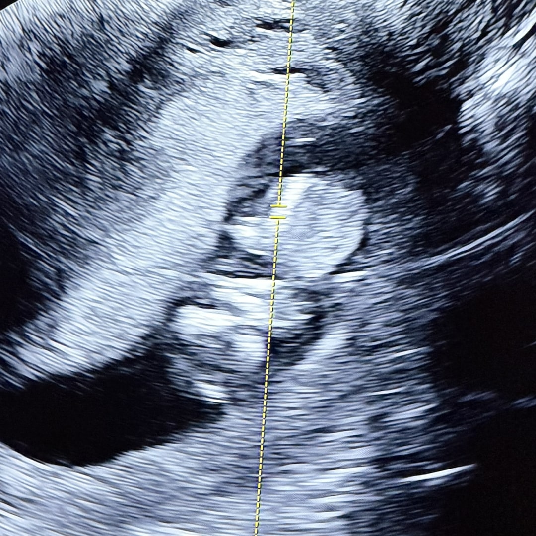 Photo shared by Jizelle for their Babylist baby registry.