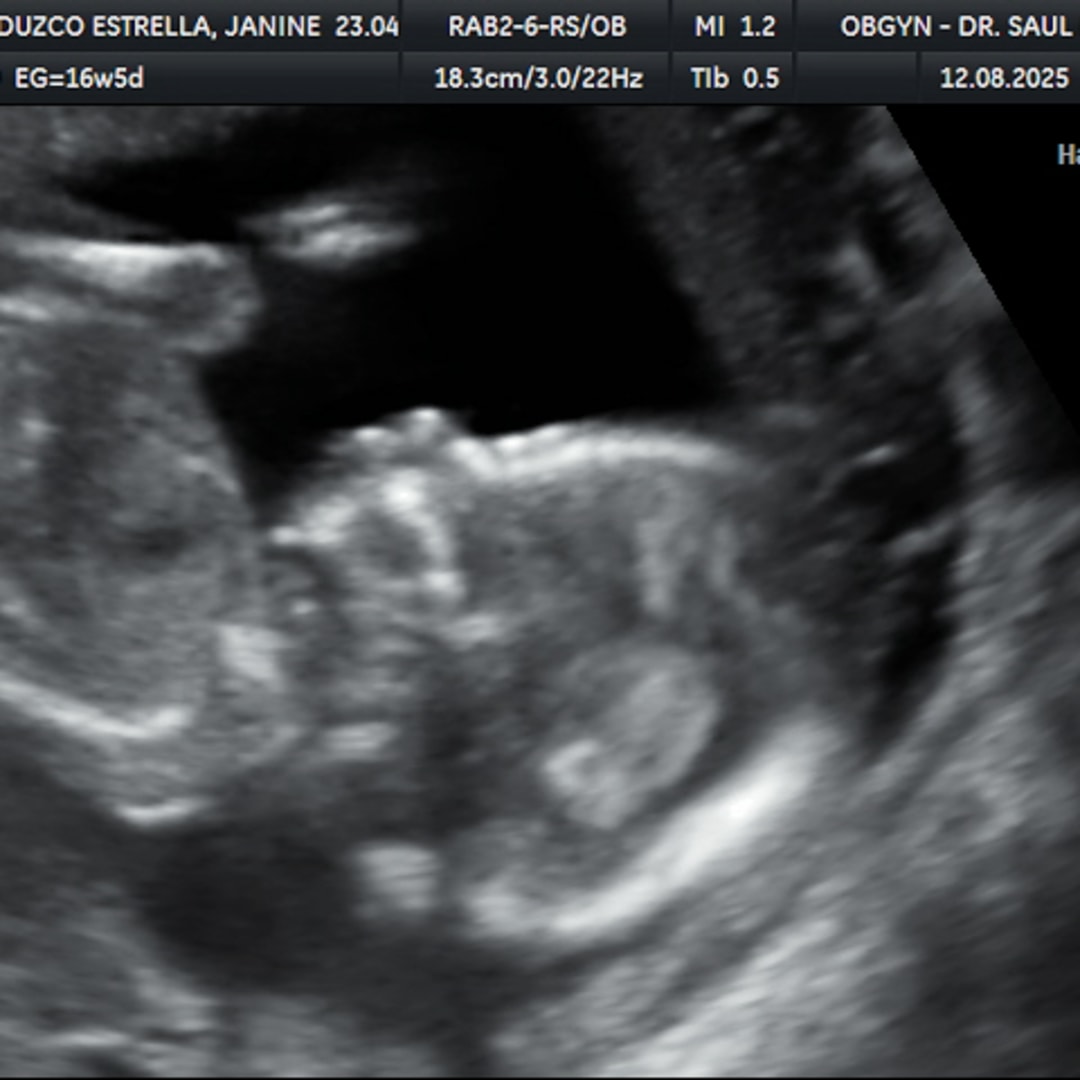 Photo shared by Janine for their Babylist baby registry.