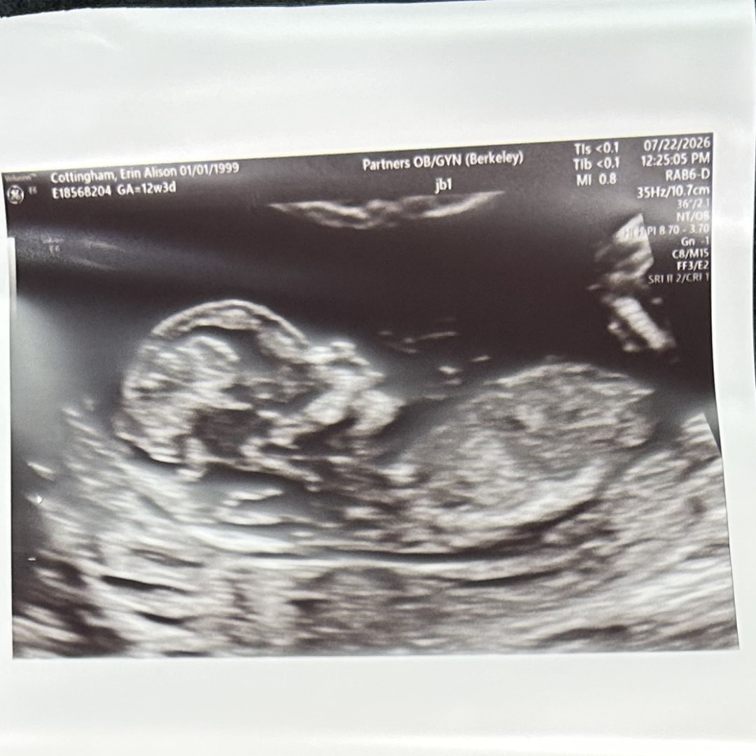 Photo shared by Erin for their Babylist baby registry.