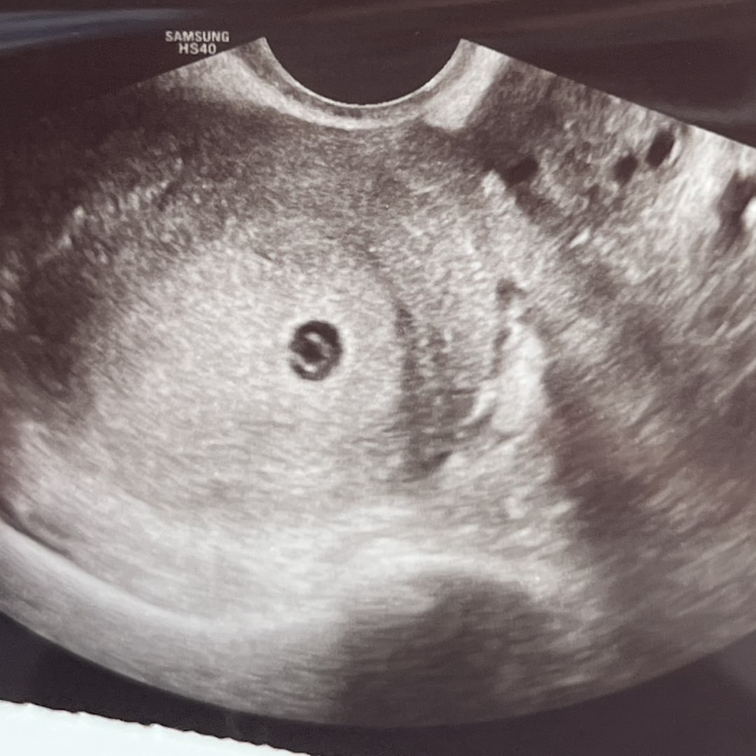 Photo shared by Jessica for their Babylist baby registry.