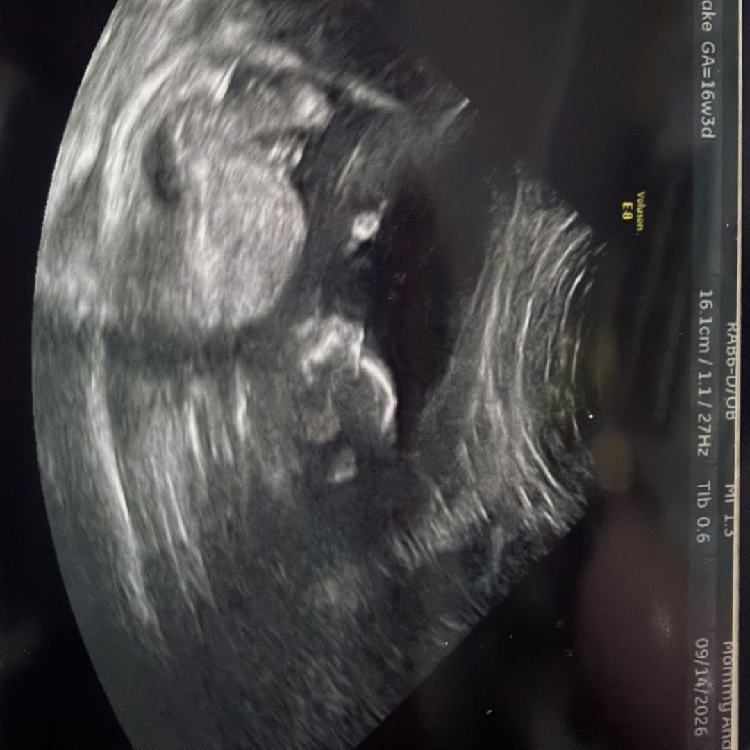 Photo shared by Cianna for their Babylist baby registry.