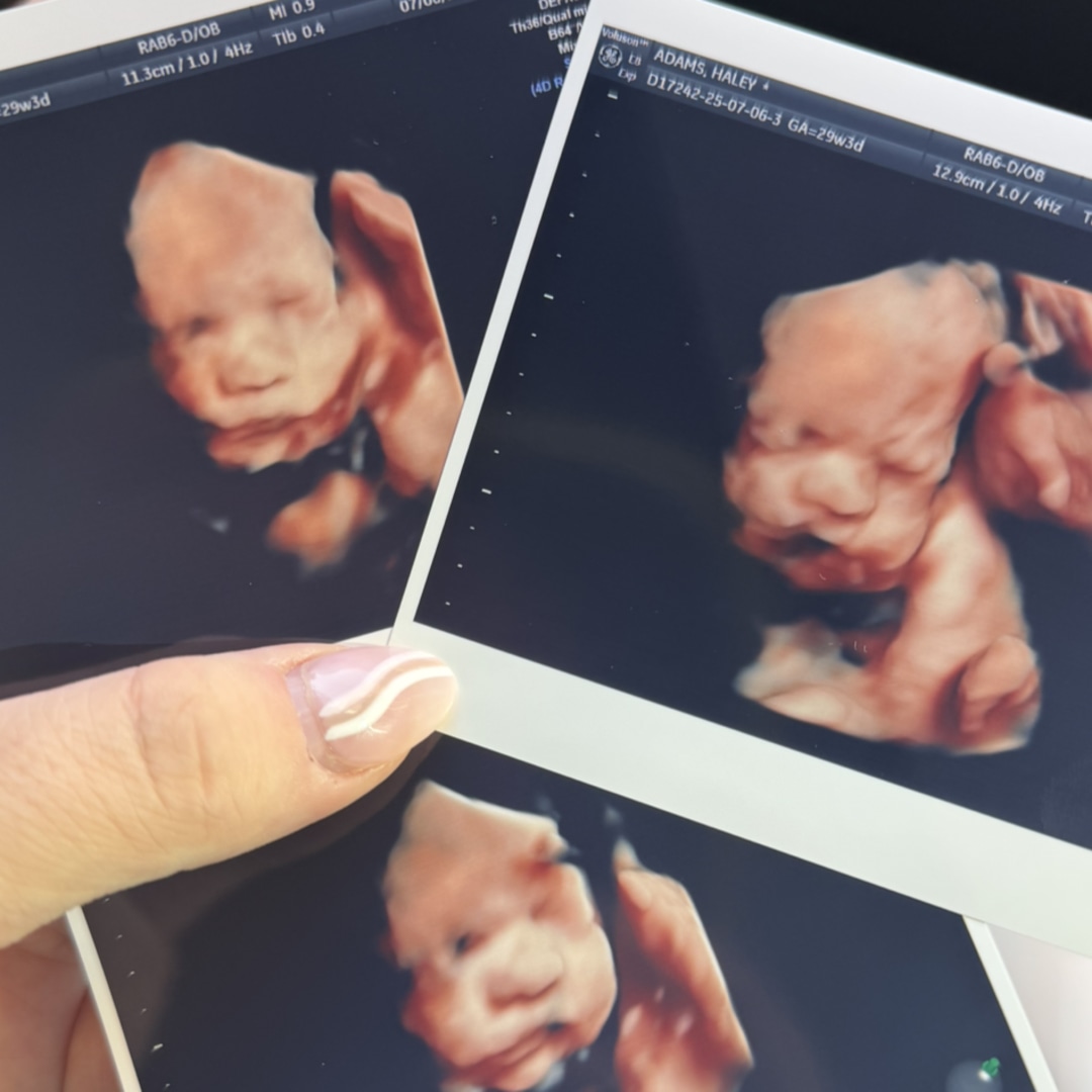 Photo shared by Haley for their Babylist baby registry.