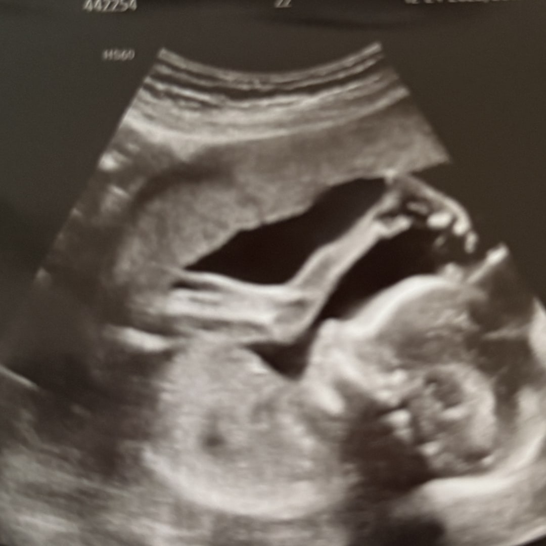 Photo shared by Athena for their Babylist baby registry.