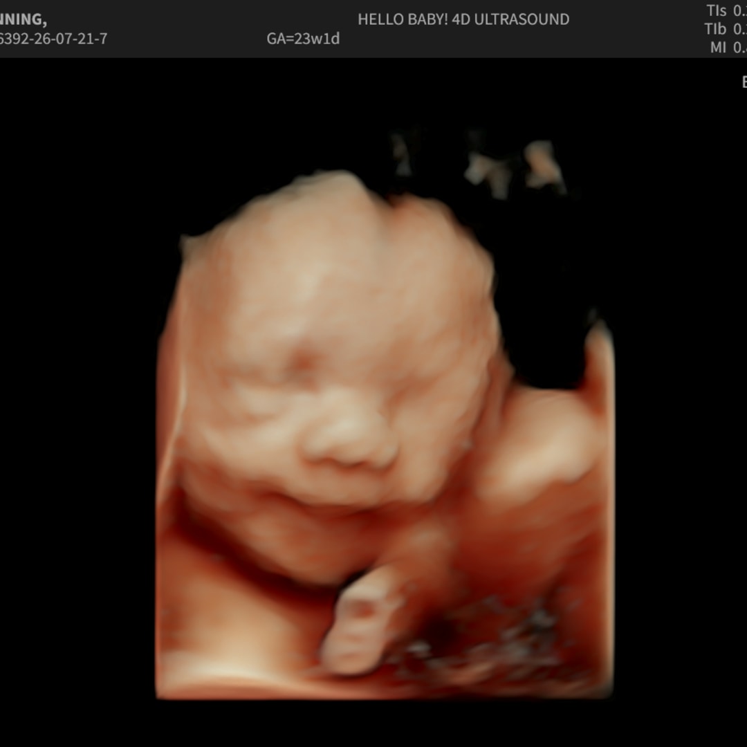 Photo shared by Alexis for their Babylist baby registry.