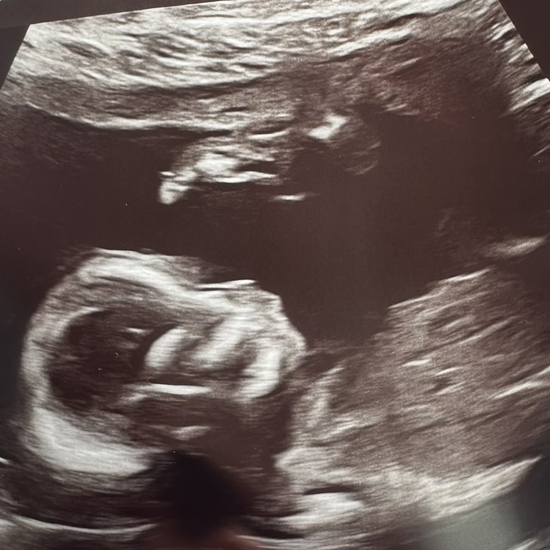 Photo shared by Jocelyn for their Babylist baby registry.