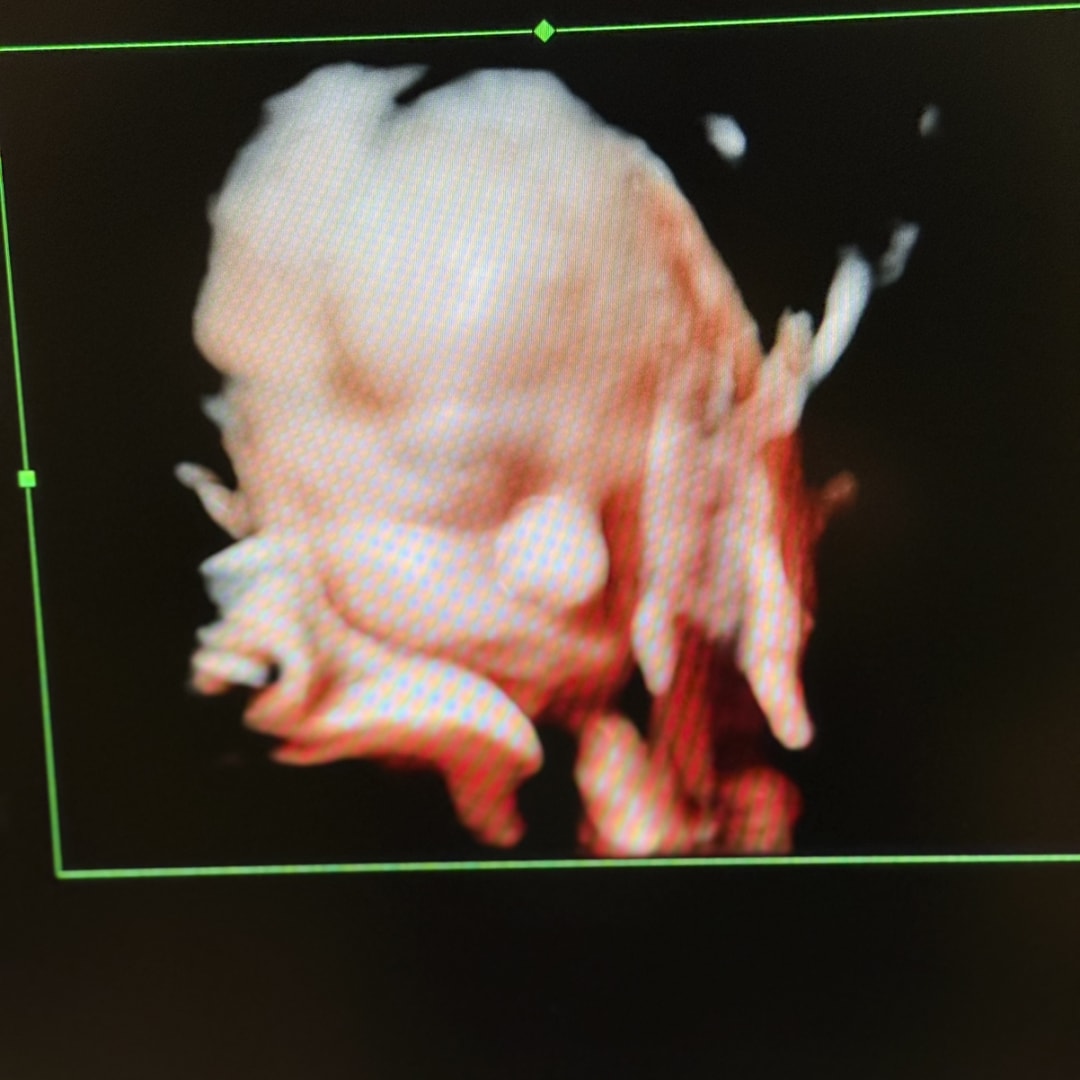 Photo shared by Rachel for their Babylist baby registry.