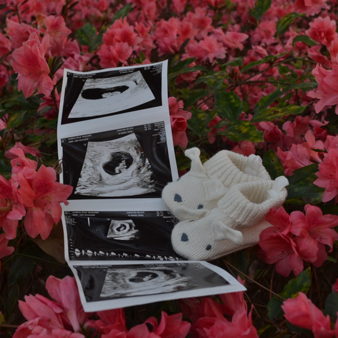 Photo shared by Kylie for their Babylist baby registry.
