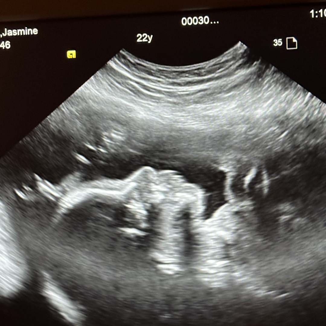 Photo shared by Jasmine for their Babylist baby registry.
