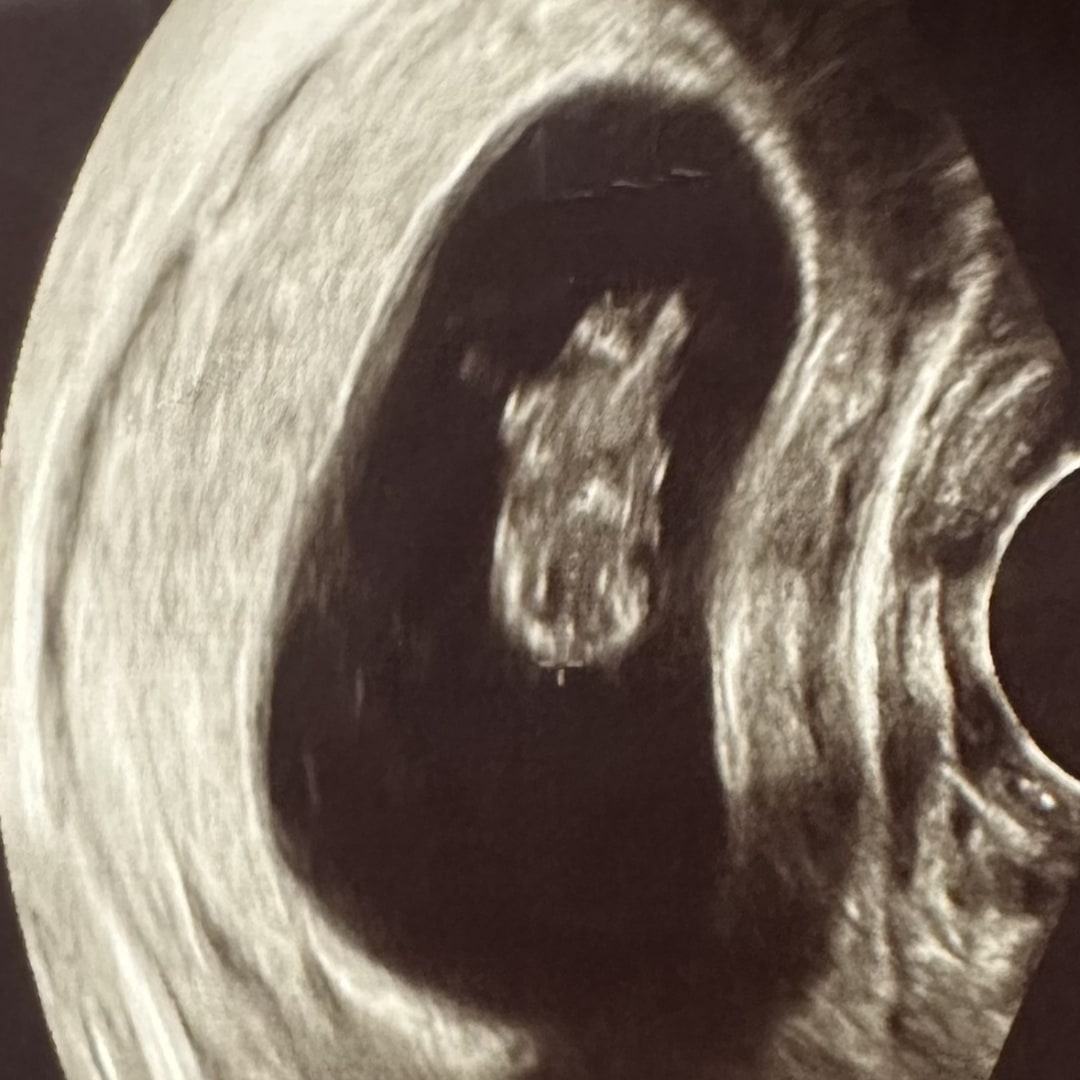 Photo shared by Bridget for their Babylist baby registry.