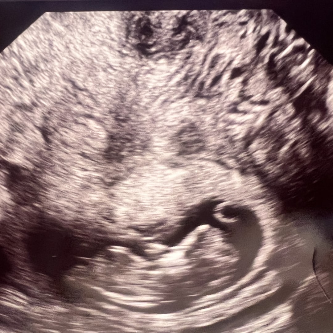 Photo shared by Banita for their Babylist baby registry.