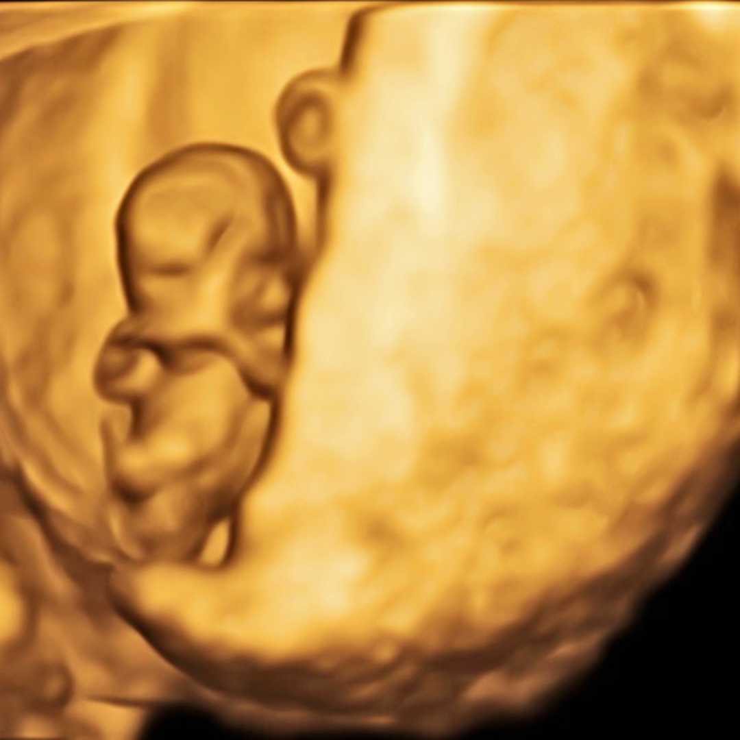 Photo shared by Jordyn for their Babylist baby registry.