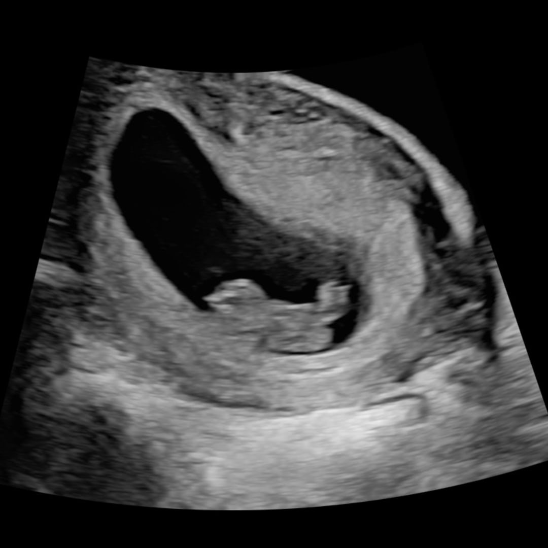 Photo shared by Bowin for their Babylist baby registry.