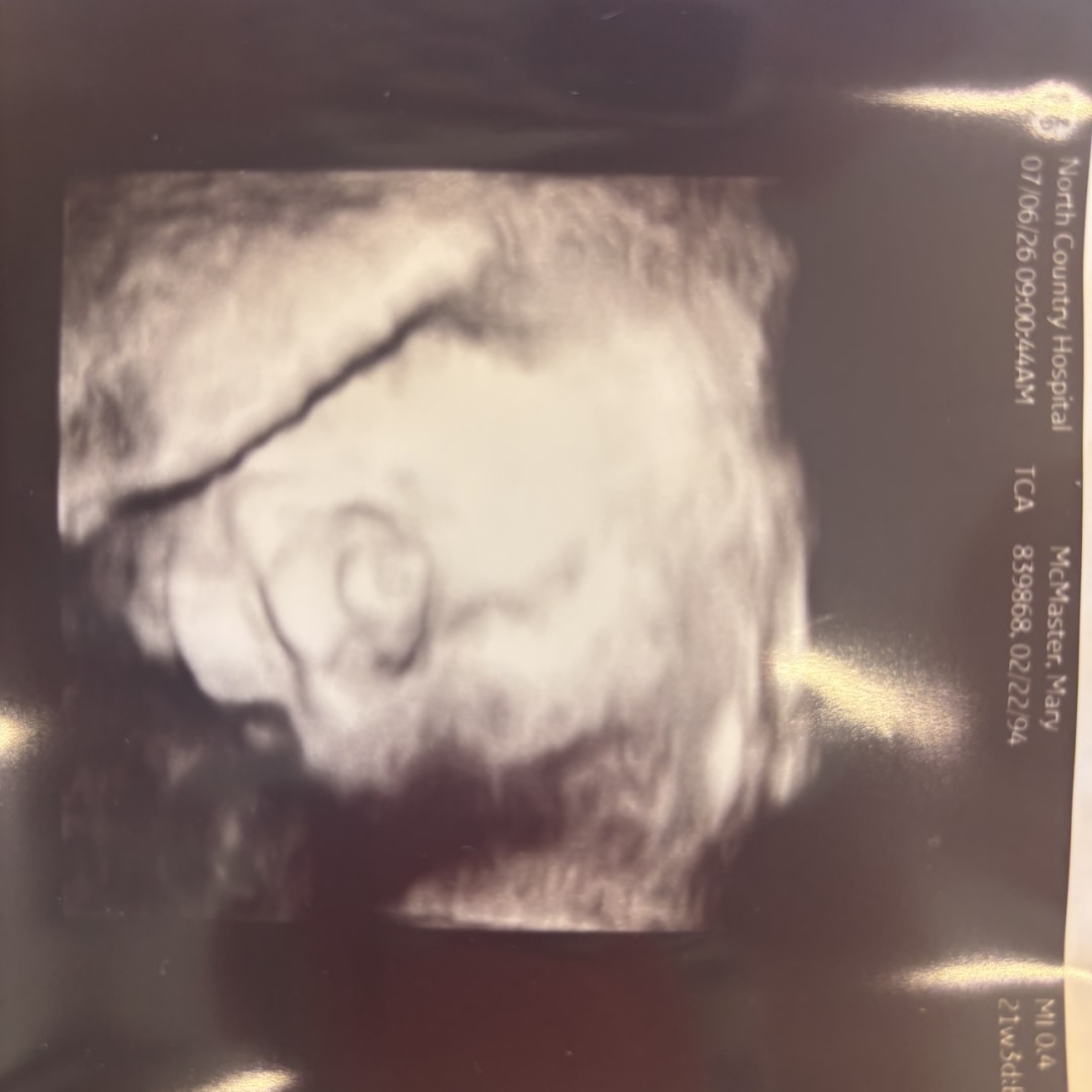 Photo shared by Marri for their Babylist baby registry.
