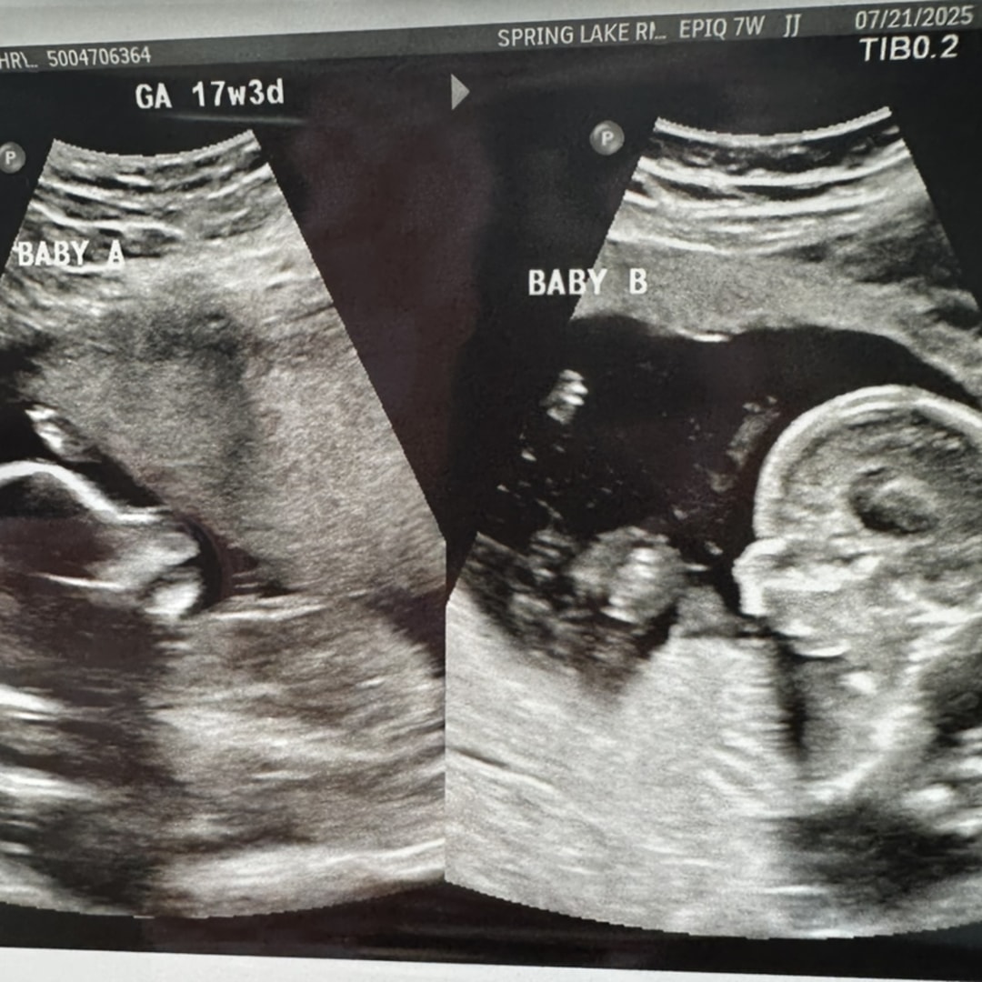Photo shared by Katie for their Babylist baby registry.