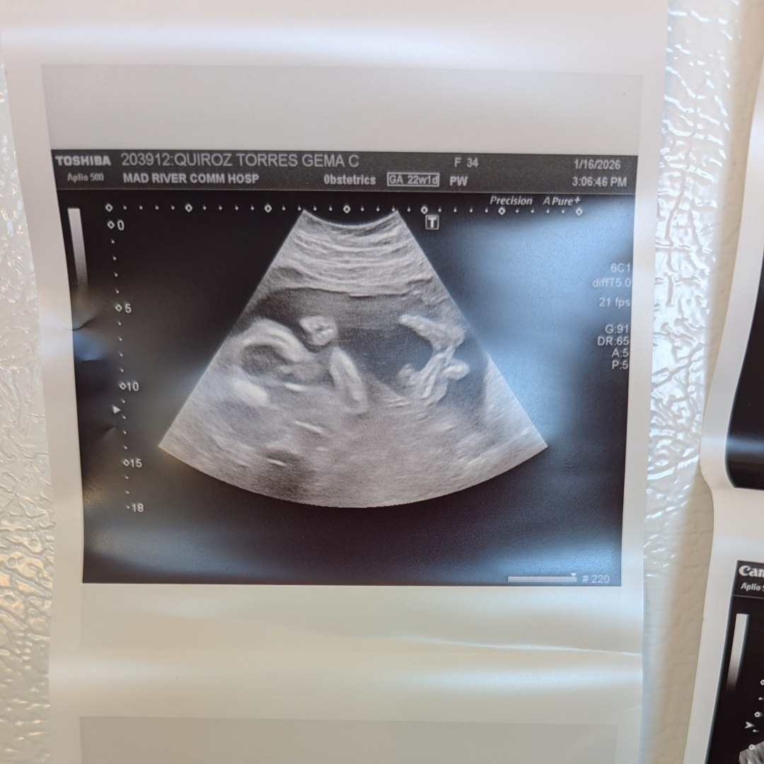 Photo shared by Gema for their Babylist baby registry.