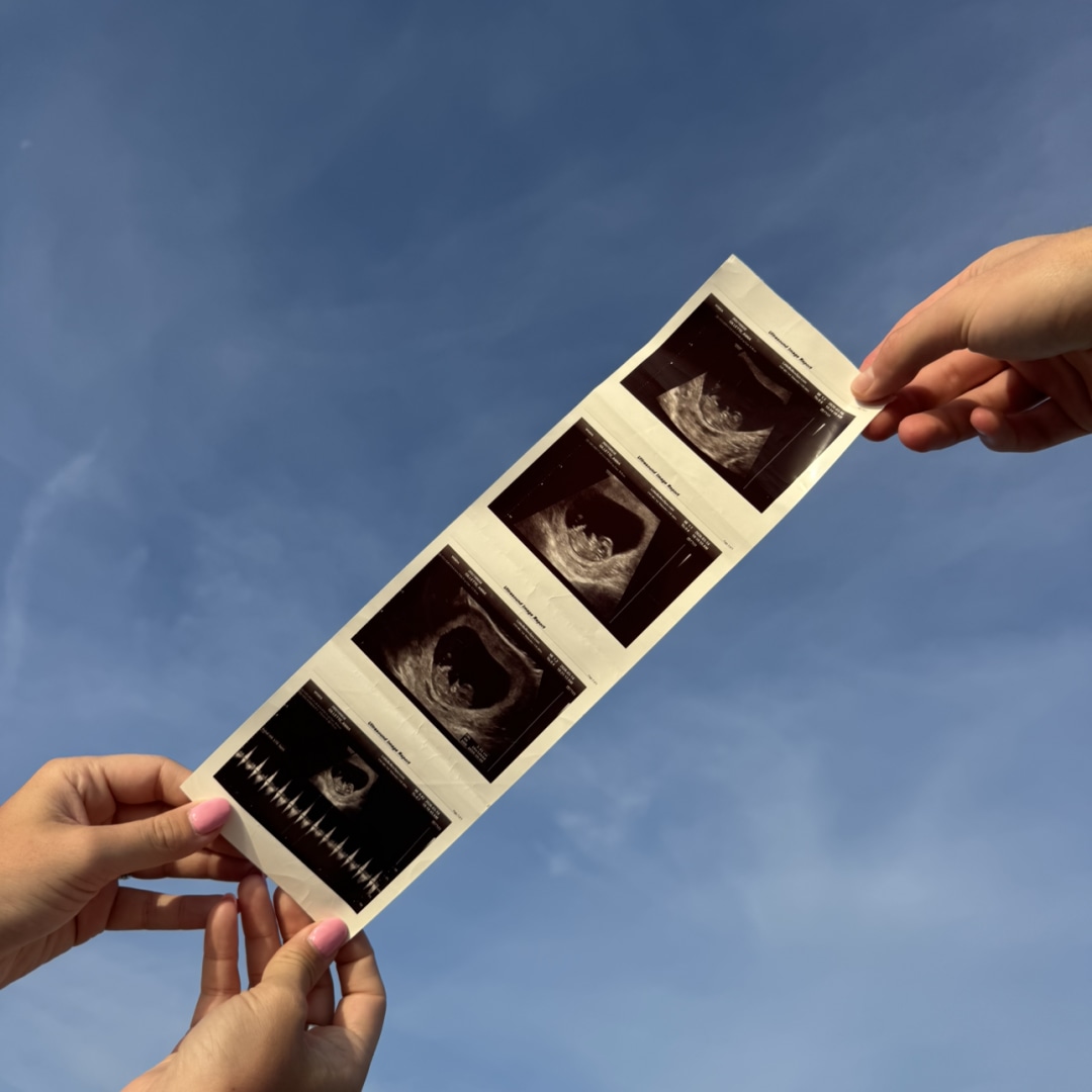 Photo shared by Anna for their Babylist baby registry.