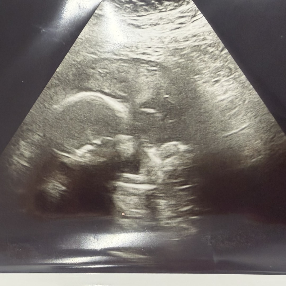 Photo shared by Finess for their Babylist baby registry.