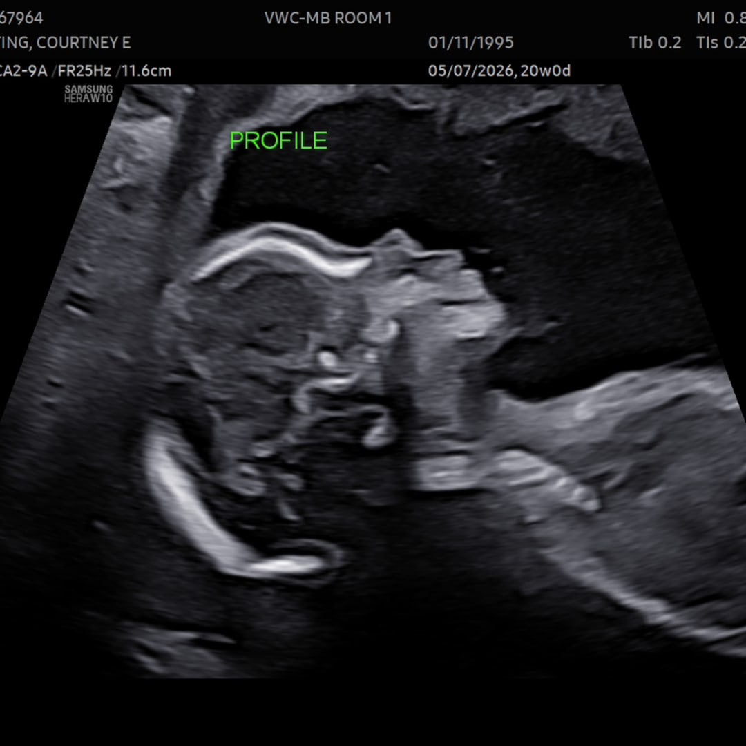 Photo shared by English for their Babylist baby registry.