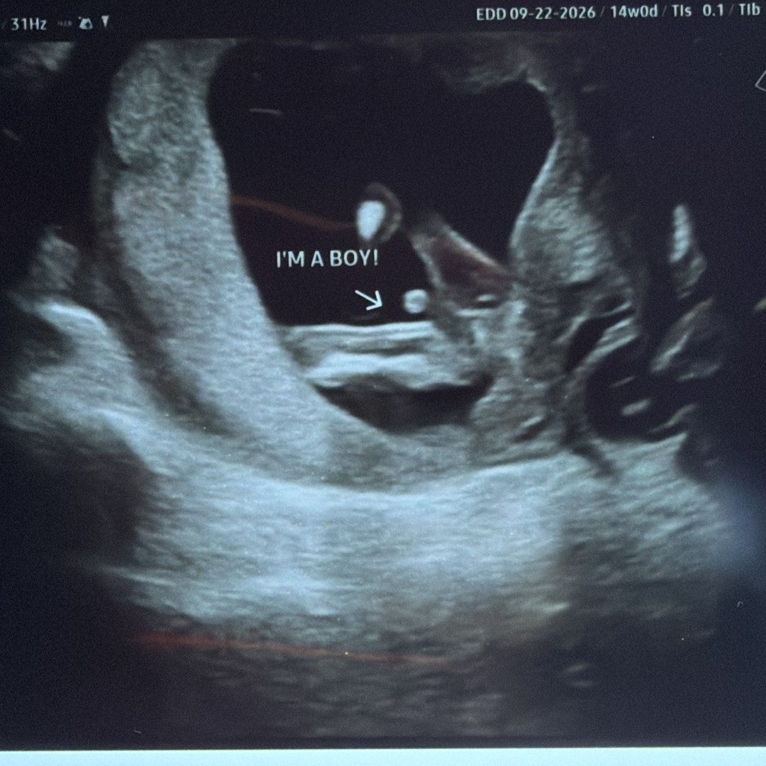 Photo shared by Alyssa for their Babylist baby registry.