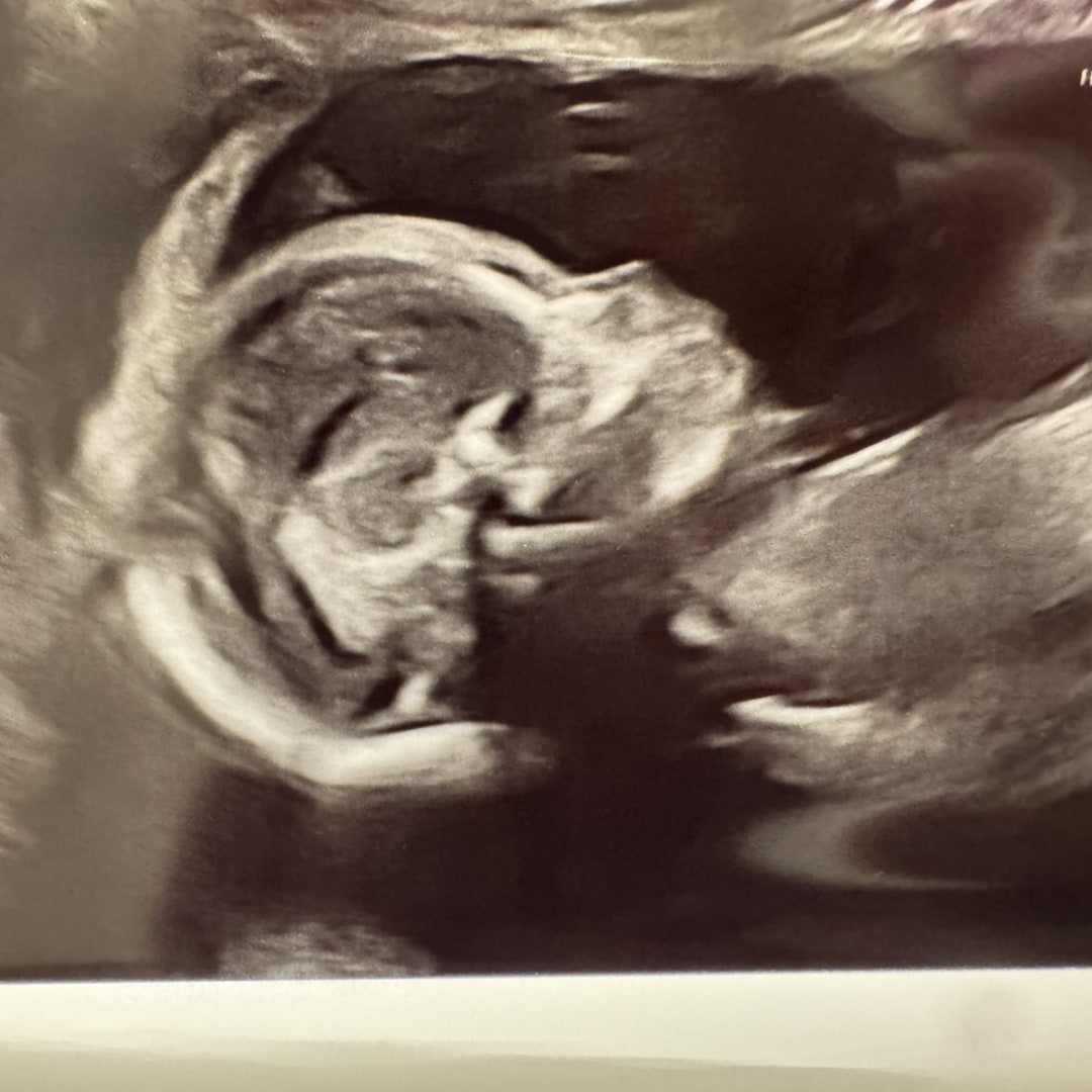 Photo shared by Sylvia for their Babylist baby registry.
