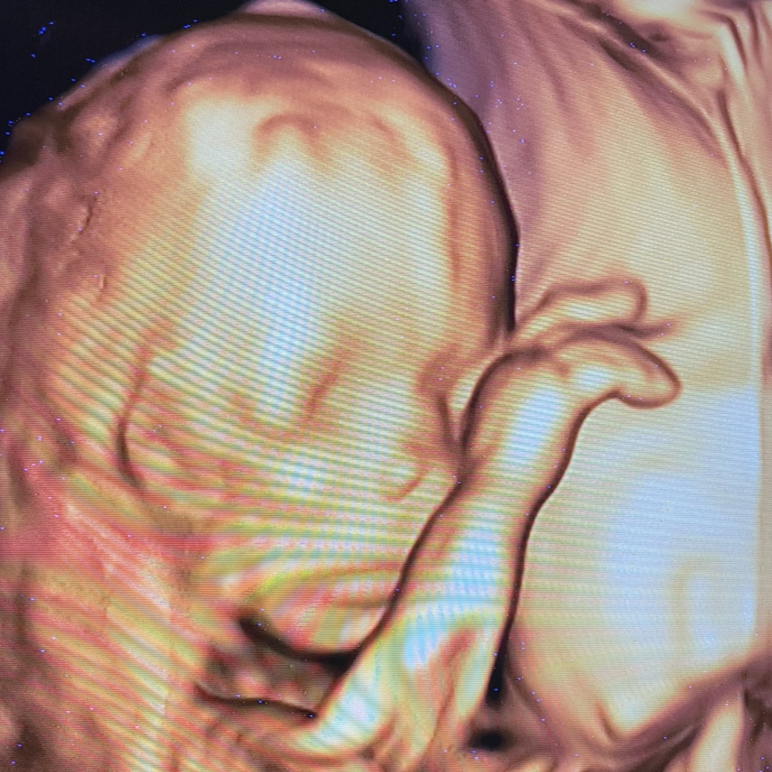 Photo shared by Ashley for their Babylist baby registry.