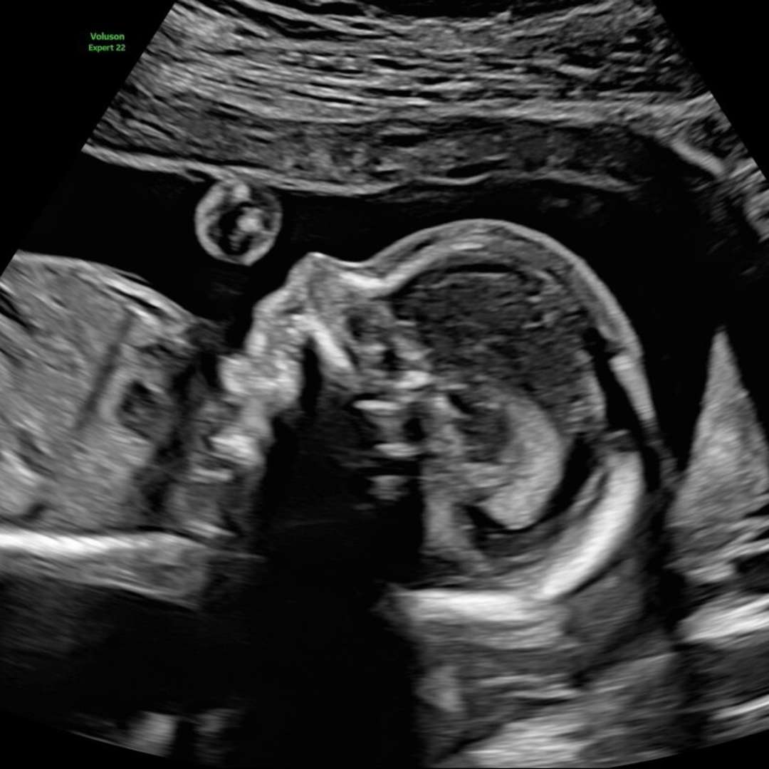 Photo shared by Kiley for their Babylist baby registry.