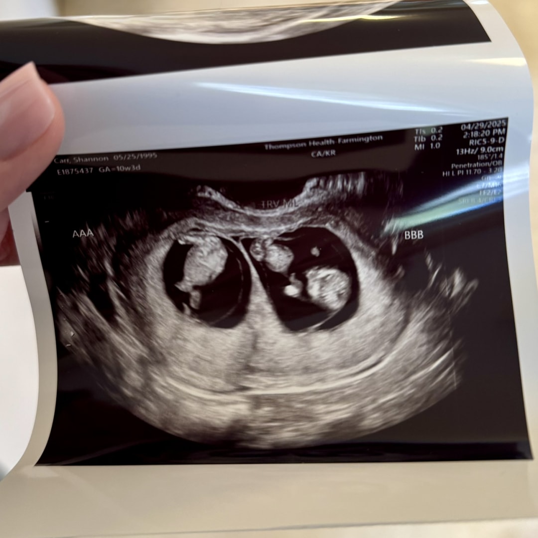 Photo shared by Shannon for their Babylist baby registry.