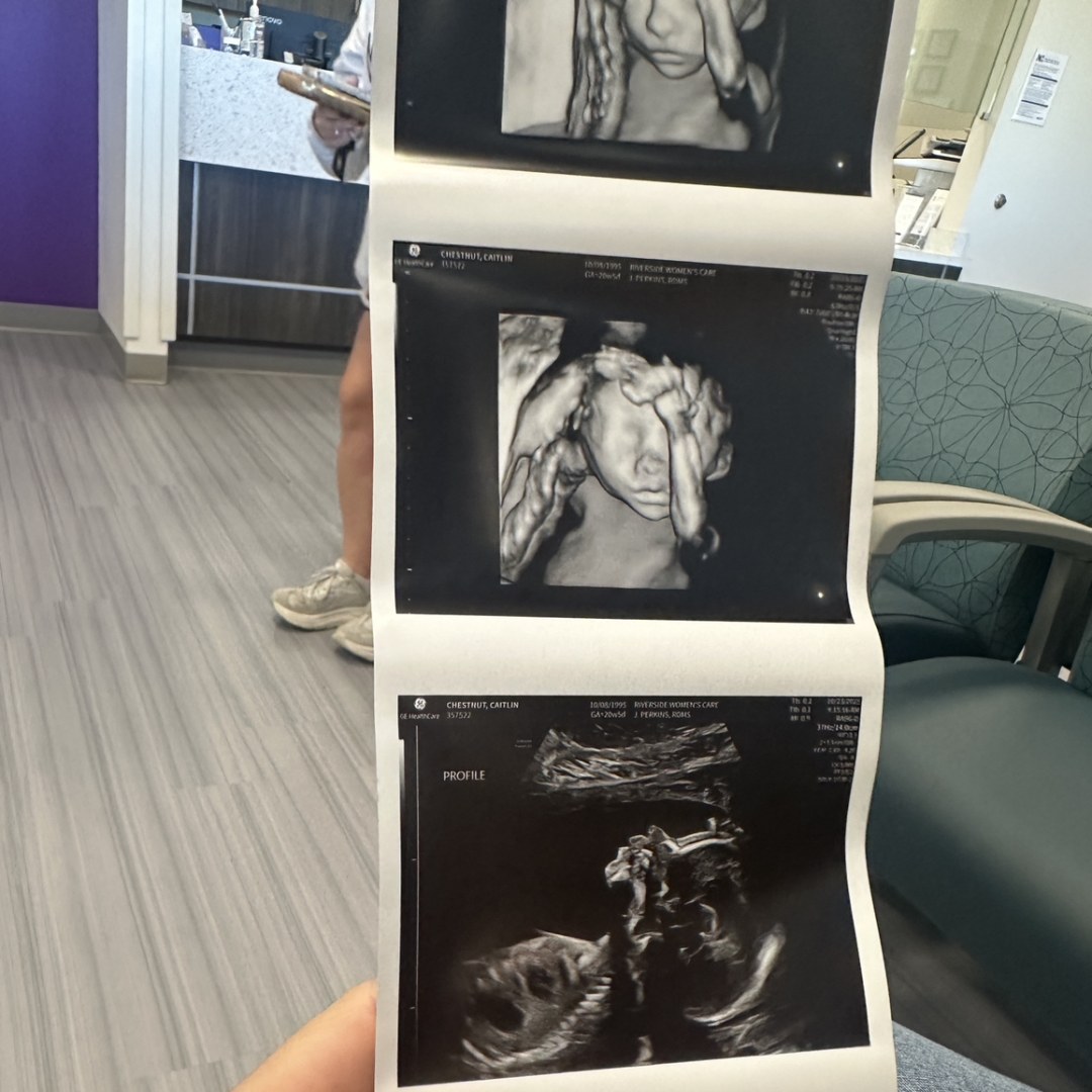 Photo shared by Caitlin for their Babylist baby registry.